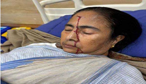ममता बनर्जी सिर में लगी चोट, एसएसकेएम अस्पताल में भर्ती